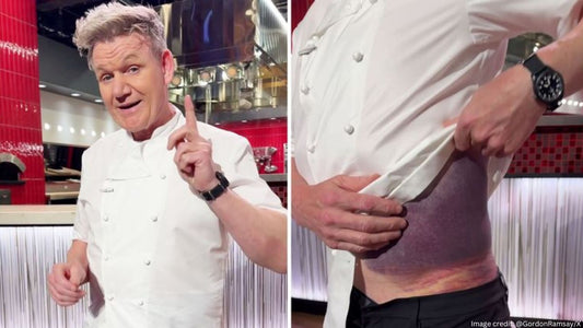 Gordon Ramsay shares Unexpected Message about his Accident